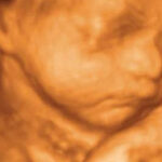 4D Scan Image 4D Scan Image