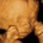 Baby 4D Scan 1