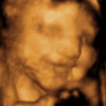 Baby 4D Scan 2