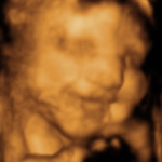 Baby 4D Scan 2 A 4D Baby Scan taken at a Peek-a-Baby clinic