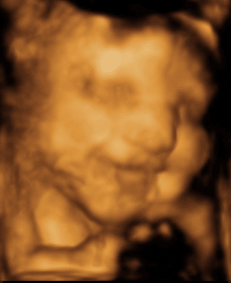 Baby 4D Scan 2