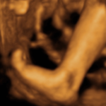 Baby 4D Scan3