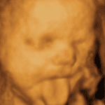 Baby 4D Scan 4