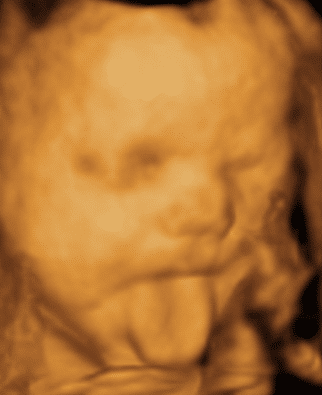 Baby 4D Scan 4