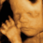 Baby 4D Scan 5 A Baby 4D Scan taken at Peek-a-Baby