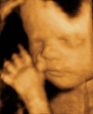 Baby 4D Scan 5