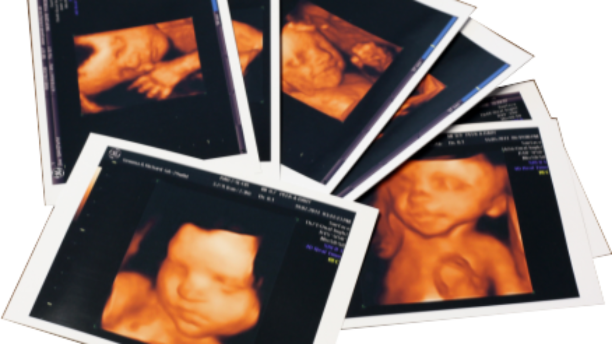 A 6 should you see ultrasound what on week 6 WEEK