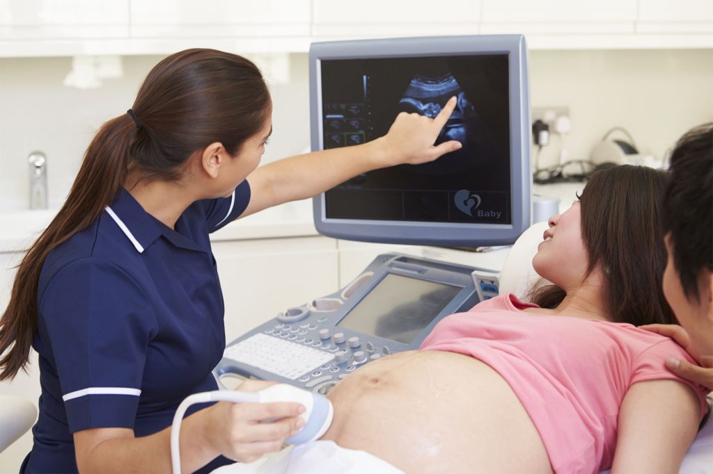 Lady having a baby scan - nurse showing baby on scan