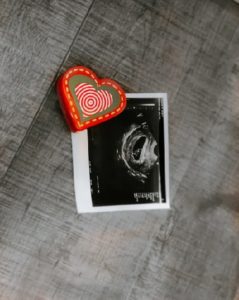Baby Scan with Magnet