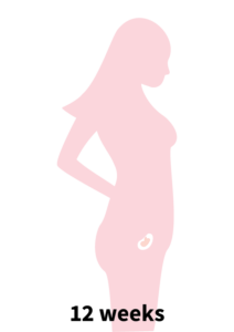 Pregnancy Stage 2 - 12 weeks