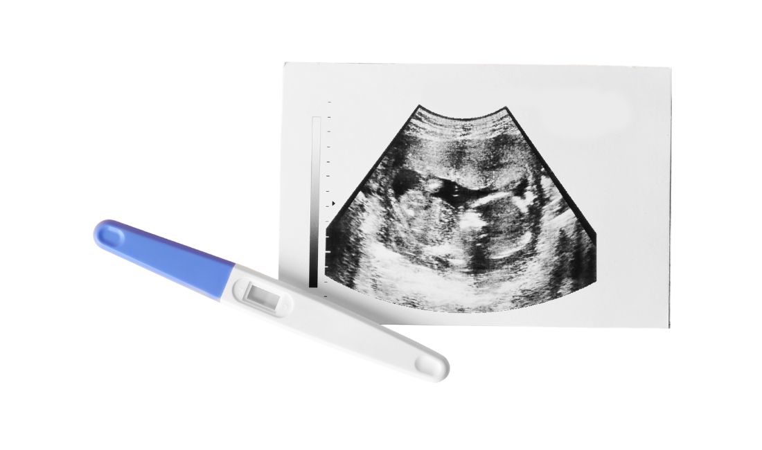 6 Week Scan