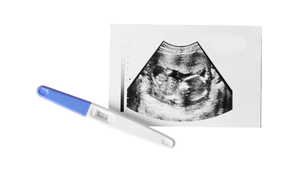 Early 6 Week Pregnancy Scan