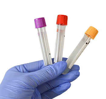 Blood Tests