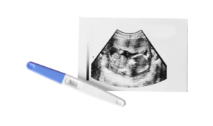 Pregnancy ultrasound image with a home pregnancy test placed in front of it.