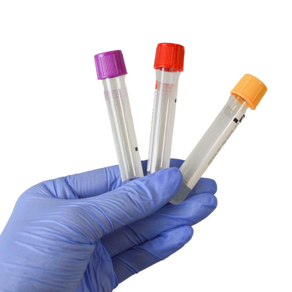 early gender blood test bristol